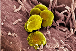 Gonorrhoea